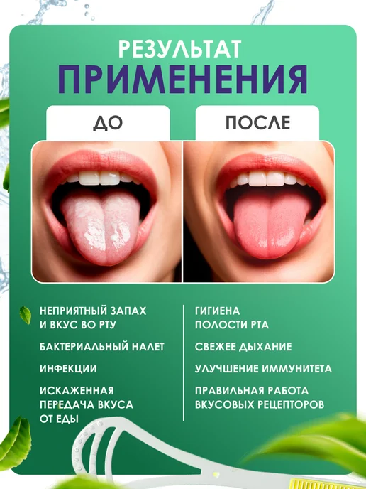 Aglenoff Скребок для чистки языка, Mak`lezu, Зеленый, 2 шт, фото 4