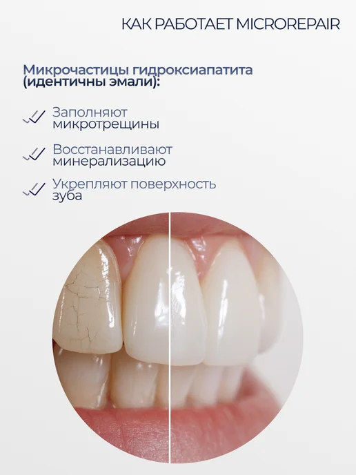 Biorepair Зубная паста для десен с пребиотиками Peribioma Gum, вариант, фото 6