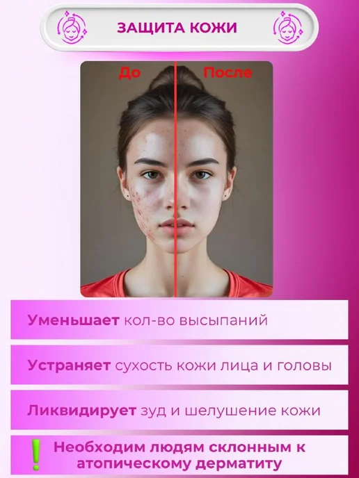 Legna Фильтр для душа, вариант, фото 3