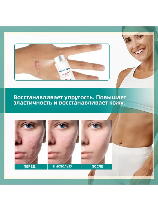 Спрей для ухода за кожей, вариант, фото 4