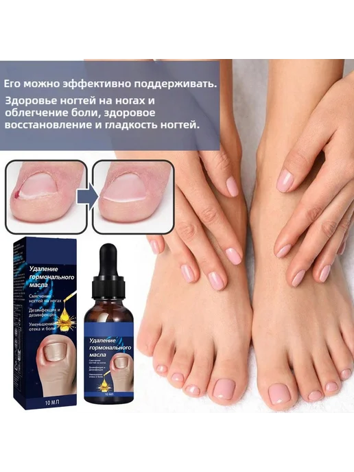 Масло для ногтей при врастании, уход 9.9 мл, 9,9 мл, фото 2