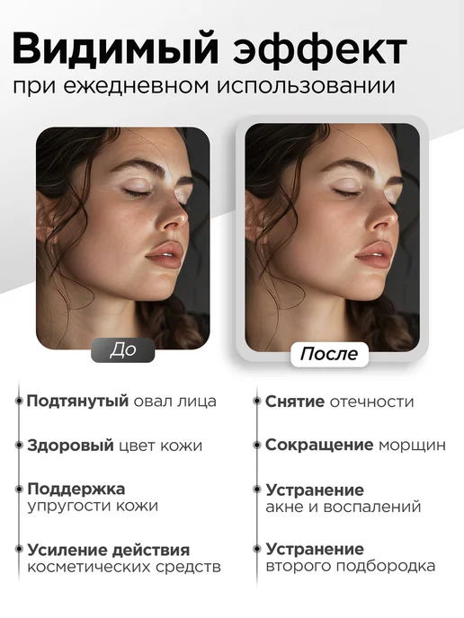 Микротоковый массажер для лица RF лифтинг, белый, фото 2