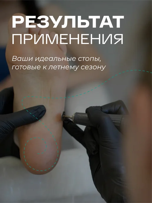 ELNAIL PRO Сменные файлы набор 20 мм M 150 штук, 20 мм, фото 5