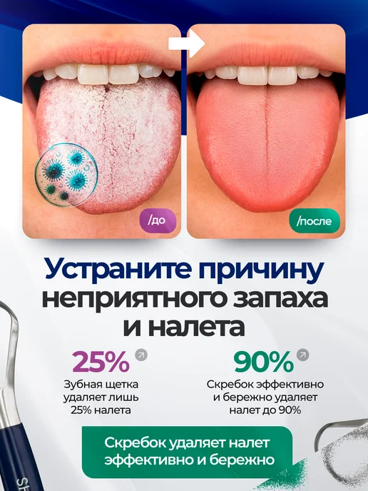 EASYbetter Скребок для языка набор 2 штуки, вариант, фото 6