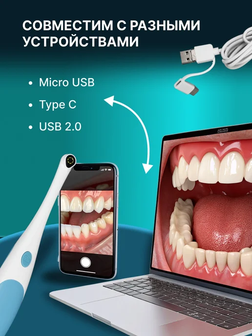 P&S COMPANY Эндоскоп зубной, зеркало для полости рта, голубой, фото 2