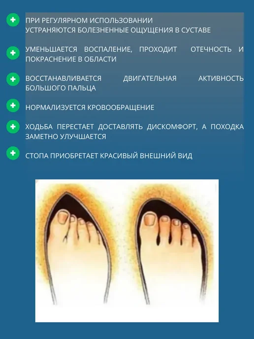 Premium качество Разделитель для пальцев ног силиконовый сепаратор, белый, фото 5