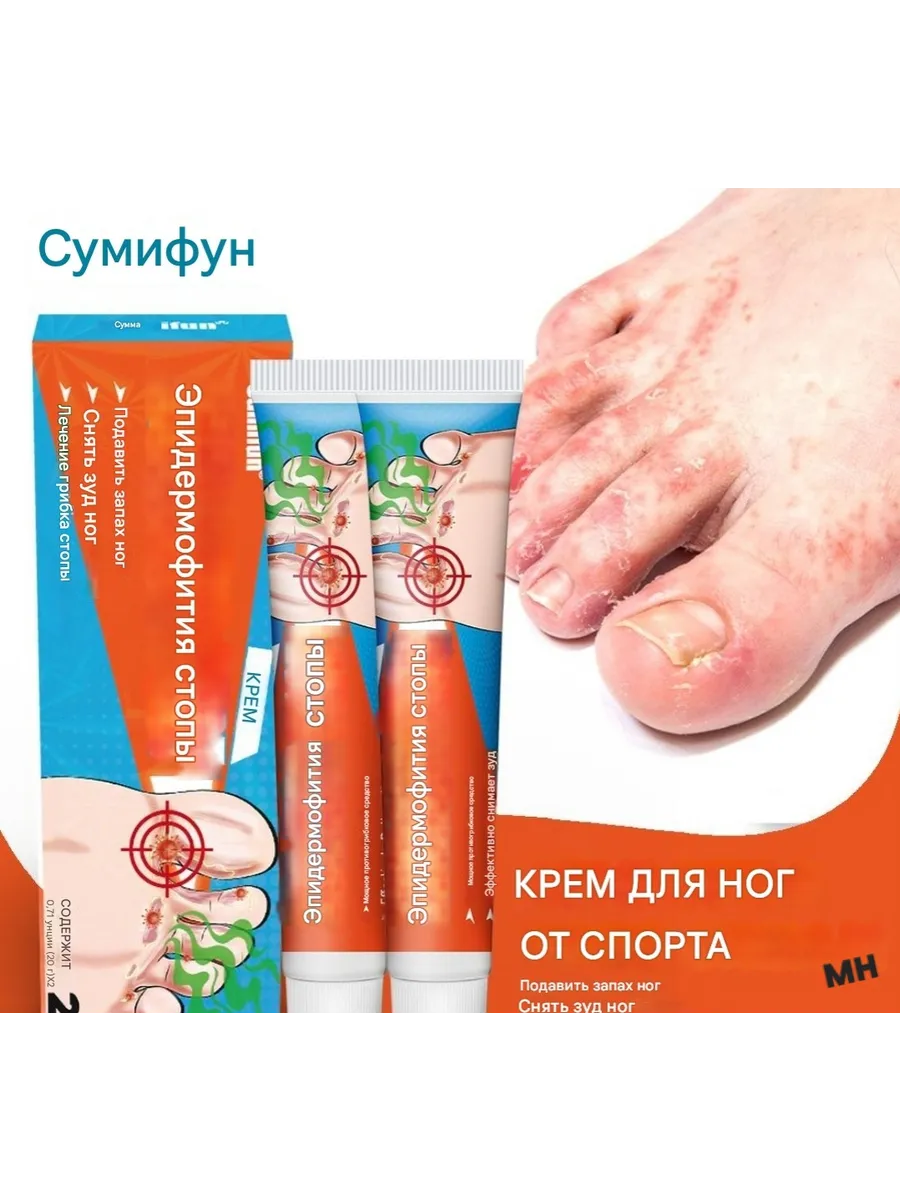 Лечебный мазь от грибка ногтей запаха и зуда ног